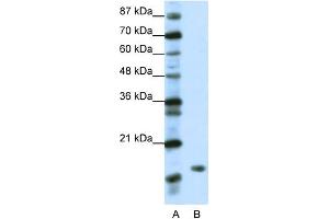 WB Suggested Anti-DR1 Antibody Titration:  1. (DR1 Antikörper  (N-Term))