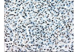 Immunohistochemistry (IHC) image for anti-Mitogen-Activated Protein Kinase Kinase 4 (MAP2K4) antibody (ABIN1499482)