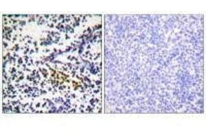 Immunohistochemistry analysis of paraffin-embedded human tonsil tissue using NYREN18 antibody. (NUB1 Antikörper  (C-Term))