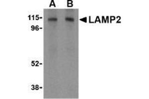 AP20058PU-N CD107b/LAMP2 antibody staining of HepG2 cell lysate by Western Blotting at (A) 1 and (B) 2 μg/ml. (LAMP2 Antikörper  (C-Term))