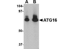 Western Blotting (WB) image for anti-ATG16 Autophagy Related 16-Like 1 (ATG16L1) (N-Term) antibody (ABIN1031245) (ATG16L1 Antikörper  (N-Term))