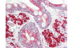 Anti-ETFA antibody IHC staining of human small intestine.