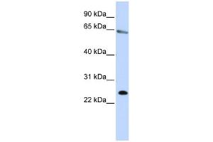 WB Suggested Anti-ZNF326 Antibody Titration:  0. (ZNF326 Antikörper  (N-Term))