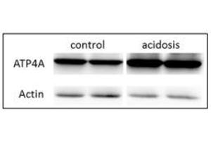 resentative western blot images of ATP4A, right panel is the quantification of the ratio of ATP4A on actin signals. (ATP4A Antikörper  (AA 786-1014))