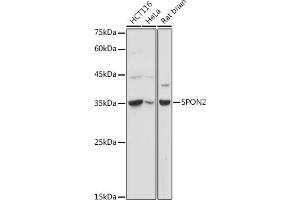 Western blot analysis of extracts of various cell lines, using SPON2 antibody (ABIN6129679, ABIN6148370, ABIN6148372 and ABIN6215647) at 1:1000 dilution. (SPON2 Antikörper  (AA 27-150))