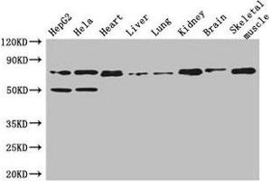 Western Blot Positive WB detected in: HepG2 whole cell lysate, Hela whole cell lysate, Mouse heart tissue, Mouse liver tissue, Mouse lung tissue, Mouse kidney tissue, Mouse brain tissue, Mouse skeletal muscle tissue All lanes: COL8A1 antibody at 3 μg/mL Secondary Goat polyclonal to rabbit IgG at 1/50000 dilution Predicted band size: 74 kDa Observed band size: 74 kDa (COL8A1 Antikörper  (AA 572-744))