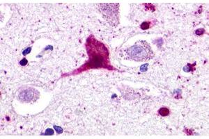 Image no. 1 for anti-G Protein-Coupled Receptor 62 (GPR62) (Cytoplasmic Domain) antibody (ABIN1048850) (GPR62 Antikörper  (Cytoplasmic Domain))