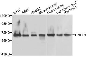 Western blot analysis of extracts of various cell lines, using CNDP1 antibody (ABIN5975565) at 1/1000 dilution. (CNDP1 Antikörper)