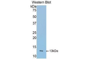 Western Blotting (WB) image for anti-Inducible T-Cell Co-Stimulator (ICOS) (AA 35-131) antibody (ABIN3207897) (ICOS Antikörper  (AA 35-131))