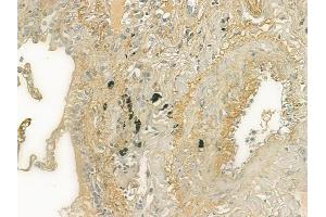 ABIN6259976 and ABIN6277005 at 1/100 staining human normal lung tissue by IHC-P. (APCS Antikörper  (Internal Region))