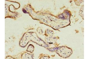 Immunohistochemistry of paraffin-embedded human placenta tissue using ABIN7148269 at dilution of 1:100 (CTHRC1 Antikörper  (AA 31-200))