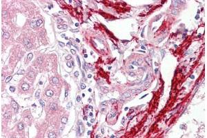 Anti-Vitronectin antibody IHC staining of human liver. (Vitronectin Antikörper)