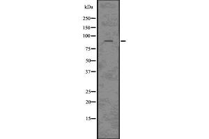 Western blot analysis of CLCN3 using HepG2 whole cell lysates (CLCN3 Antikörper  (N-Term))