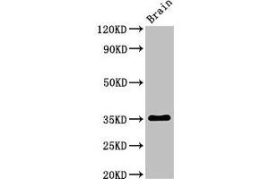 Western Blot Positive WB detected in: Rat brain tissue All lanes: Metrnl antibody at 3 μg/mL Secondary Goat polyclonal to rabbit IgG at 1/50000 dilution Predicted band size: 35, 36 kDa Observed band size: 35 kDa (METRNL Antikörper  (AA 46-311))