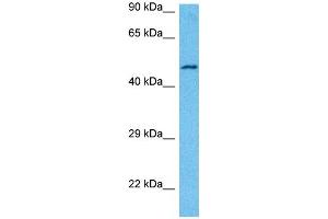 Western Blotting (WB) image for anti-Activin Receptor Type I (ACRV1) (N-Term) antibody (ABIN2782108)