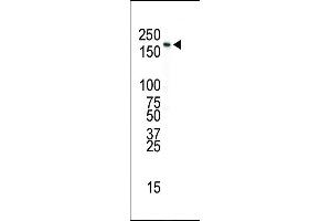 Western blot analysis of anti-INSR Pab in SK-BR-3 cell lysate (Insulin Antikörper  (N-Term))