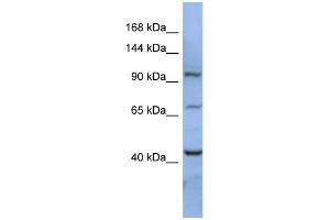 RBM12 antibody used at 1 ug/ml to detect target protein. (RBM12 Antikörper  (N-Term))