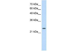 WB Suggested Anti-TNNI1 Antibody Titration:  0.