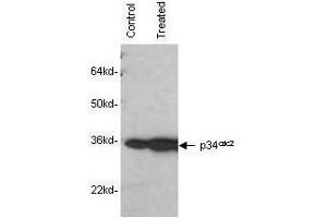 Mab anti-Human p34cdc2 antibody was used to detect human p34cdc2by western blot in untreated (control) and drug treated (10 µM genistein) lysates of MCF-7 cells. (Cdc2, p34 Antikörper)