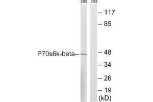 Western blot analysis of extracts from 293 cells, using p70 S6 Kinase β (Ab-423) antibody. (RPS6KB2 Antikörper  (Ser423))