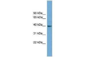Western Blotting (WB) image for anti-Guanine Nucleotide Binding Protein (G Protein), alpha Inhibiting Activity Polypeptide 3 (GNAI3) (N-Term) antibody (ABIN929083)