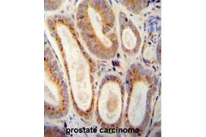 Immunohistochemistry (Paraffin-embedded Sections) (IHC (p)) image for anti-WAP Four-Disulfide Core Domain 12 (WFDC12) (AA 73-102), (C-Term) antibody (ABIN955573)