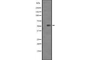 Western blot analysis of KRT82 expression in Mouse heart tissue lysates ,The lane on the left is treated with the antigen-specific peptide. (Keratin 82 Antikörper  (C-Term))
