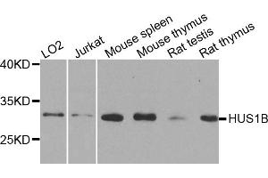 Western blot analysis of extracts of various cell lines, using HUS1B antibody. (HUS1B Antikörper)