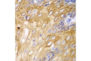 Immunohistochemistry of paraffin-embedded human esophagus using Cyclin D1 antibody (ABIN6127677, ABIN6138079, ABIN6138081 and ABIN6213800) at dilution of 1:100 (40x lens).