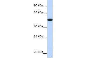 WB Suggested Anti-C9orf43 Antibody Titration: 0. (C9orf43 Antikörper  (Middle Region))