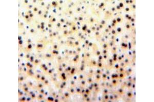 Used in DAB staining on fromalin fixed paraffin-embedded Liver tissue (GATA1 Antikörper  (AA 20-265))