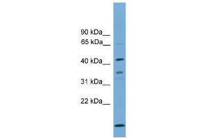 WB Suggested Anti-APOL5 Antibody Titration: 0.