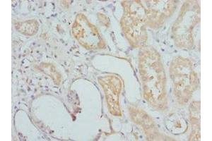 Immunohistochemistry of paraffin-embedded human kidney tissue using ABIN7155677 at dilution of 1:100 (DLX2 Antikörper  (AA 1-140))