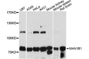 Western blot analysis of extracts of various cell lines, using MAN1B1 antibody (ABIN6291169) at 1:3000 dilution. (MAN1B1 Antikörper)