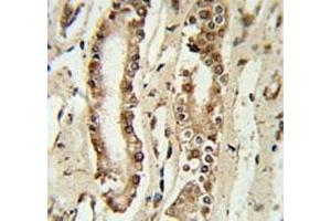 Immunohistochemistry (IHC) image for anti-Forkhead Box P1 (FOXP1) (AA 650-677) antibody (ABIN3030993)