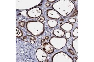 Immunohistochemical staining of human thyroid gland with ACTR6 polyclonal antibody  shows strong cytoplasmic positivity in glandular cells. (ACTR6 Antikörper)