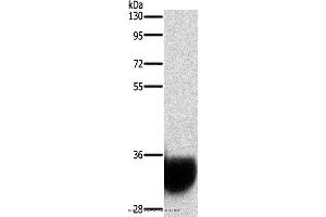 Western blot analysis of Human fetal brain tissue, using GPM6A Polyclonal Antibody at dilution of 1:1050 (GPM6A Antikörper)