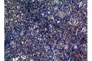 Immunohistochemistry (IHC) analysis of paraffin-embedded Human Tonsils, antibody was diluted at 1:100. (ICOS Antikörper)