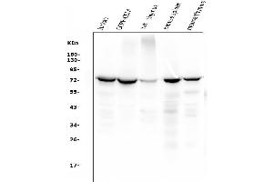 Western blot analysis of ZAP70 using anti-ZAP70 antibody (ABIN7602981).