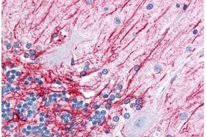 Human Brain, Cerebellum: Formalin-Fixed, Paraffin-Embedded (FFPE) (GFAP Antikörper)