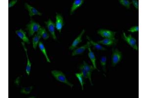 Immunofluorescence staining of Hela cells with ABIN7146245 at 1:200, counter-stained with DAPI. (Cadherin 9 Antikörper  (AA 131-314))
