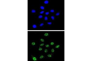Immunofluorescence (IF) image for anti-Dyskeratosis Congenita 1, Dyskerin (DKC1) antibody (ABIN3002360) (DKC1 Antikörper)