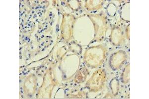 Immunohistochemistry of paraffin-embedded human kidney tissue using ABIN7168739 at dilution of 1:100 (PLA2R1 Antikörper  (AA 395-530))