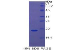 SDS-PAGE analysis of Cow Cyclophilin A Protein. (PPIA Protein)