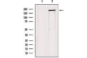 Western blot analysis of extracts from Hela, using Collagen V α1 Antibody. (COL5A1 Antikörper  (Internal Region))