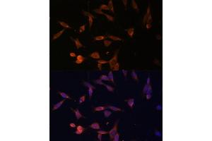 Immunofluorescence analysis of NIH-3T3 cells using UMPS Polyclonal Antibody (ABIN6128901, ABIN6149927, ABIN6149929 and ABIN6217183) at dilution of 1:100 (40x lens). (UMPS Antikörper  (AA 100-260))