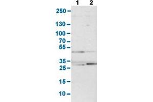Western Blot analysis with FDFT1 polyclonal antibody . (FDFT1 Antikörper  (AA 10-148))