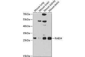Western blot analysis of extracts of various cell lines, using R antibody (ABIN6133004, ABIN6146574, ABIN6146575 and ABIN6214549) at 1:1000 dilution. (RAB34 Antikörper  (AA 1-259))