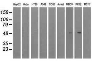 Image no. 6 for anti-Lysyl Oxidase (LOX) (AA 22-168) antibody (ABIN1491218) (LOX Antikörper  (AA 22-168))