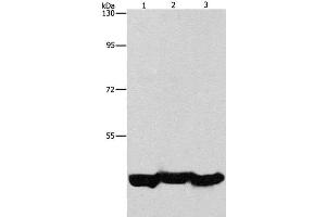 Western Blot analysis of A549 cell and Mouse liver tissue, hepG2 cell using PGK1 Polyclonal Antibody at dilution of 1:1000 (PGK1 Antikörper)
